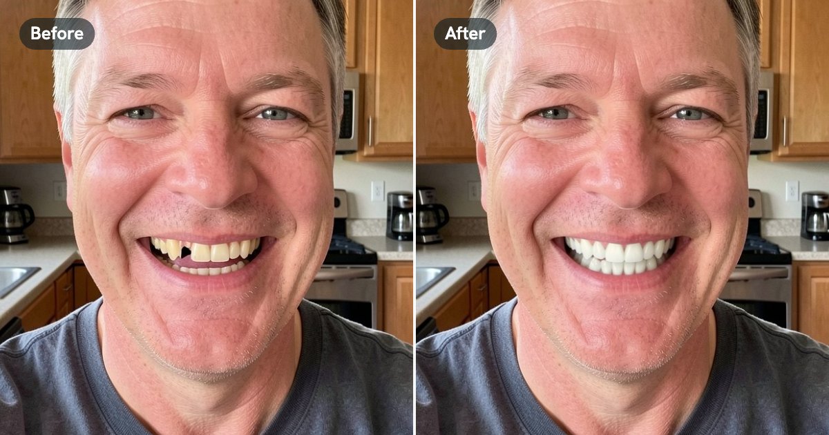 A patient's smile before and after an AI preview of dental implants